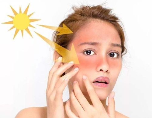 Anti-aging After-sun repair